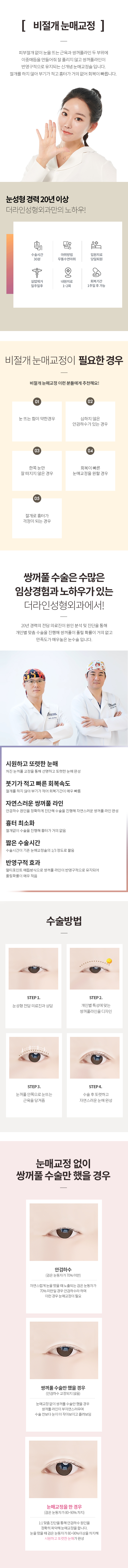 눈매교정술